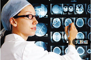 高剂量更安全？乳腺癌术后建议短期放疗