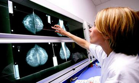 乳腺癌年轻化令人担忧 专家呼吁20岁就需筛查