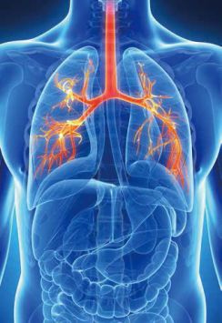 肺癌为何不容易早期发现