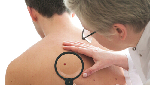 皮肤癌早期症状挨个数 早知道 早预防